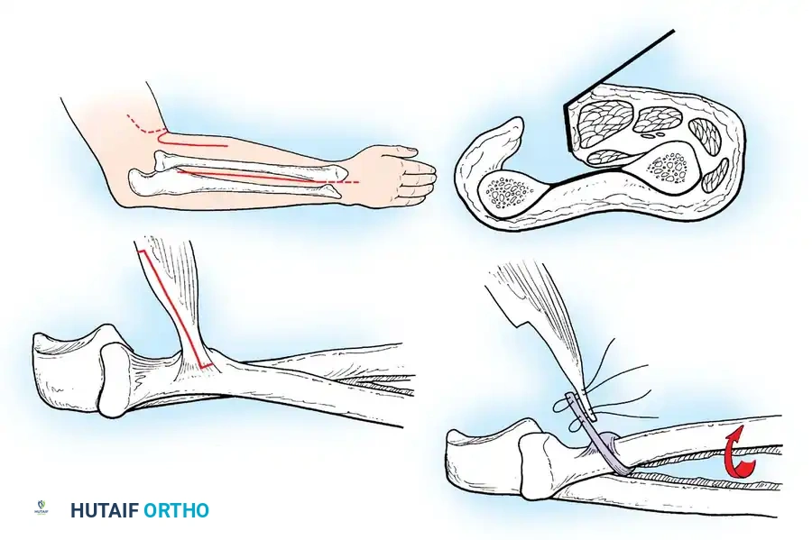 Hutaifortho's Orthopaedic Diagram