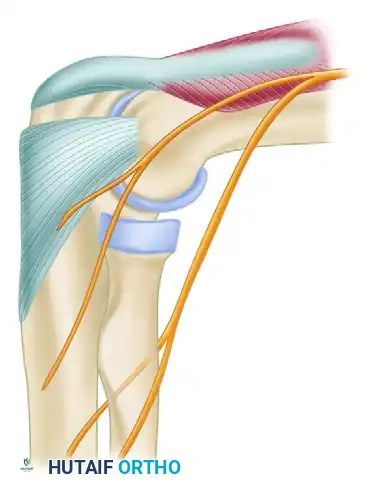 PORTAL PLACEMENT Surgical Diagram