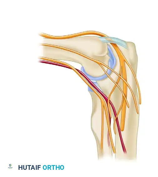 PORTAL PLACEMENT Surgical Diagram