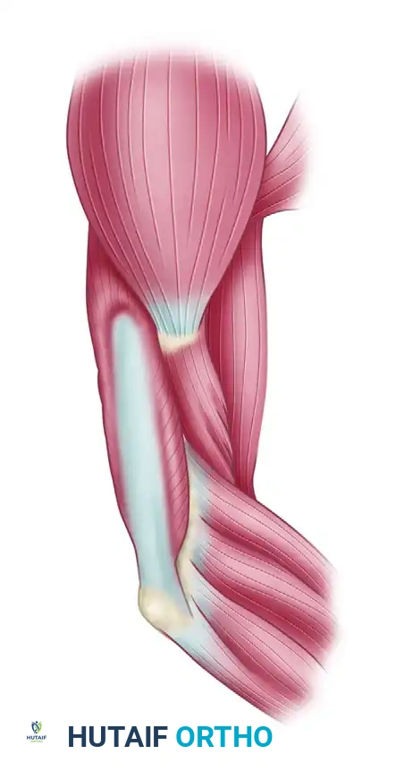 Posterior Deltoid-to-Triceps Transfer: Comprehensive Surgical Guide