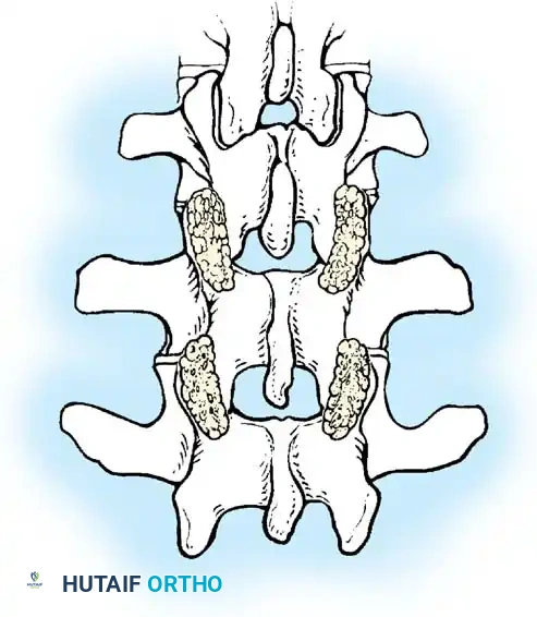 Hutaifortho's Orthopaedic Diagram