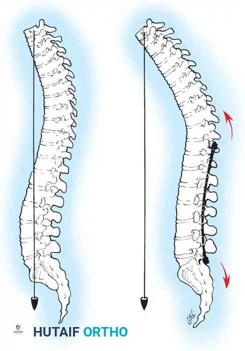 Hutaifortho's Orthopaedic Diagram