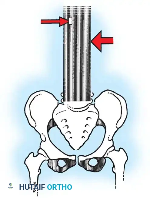 Hutaifortho's Orthopaedic Diagram