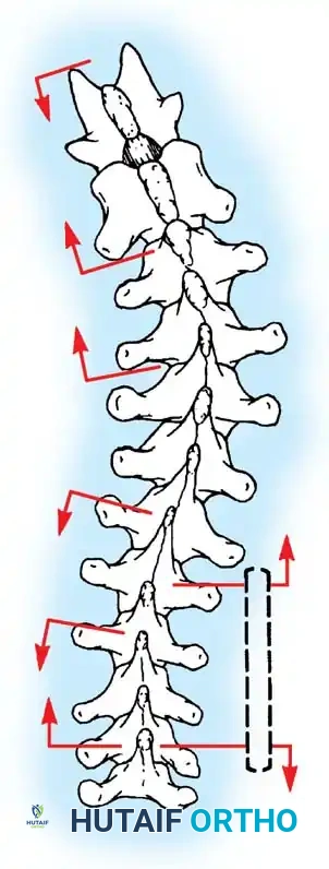 Hutaifortho's Orthopaedic Diagram