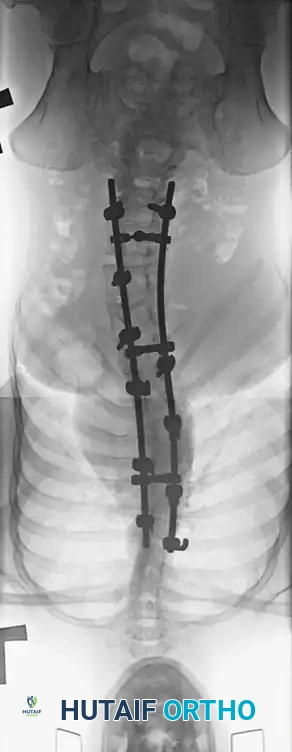 Hutaifortho's Orthopaedic Diagram