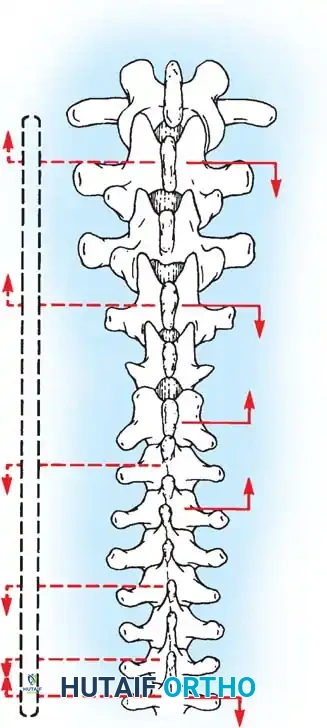 Hutaifortho's Orthopaedic Diagram