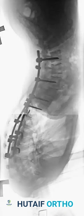 Hutaifortho's Orthopaedic Diagram