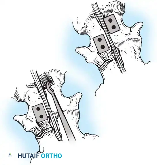 Hutaifortho's Orthopaedic Diagram