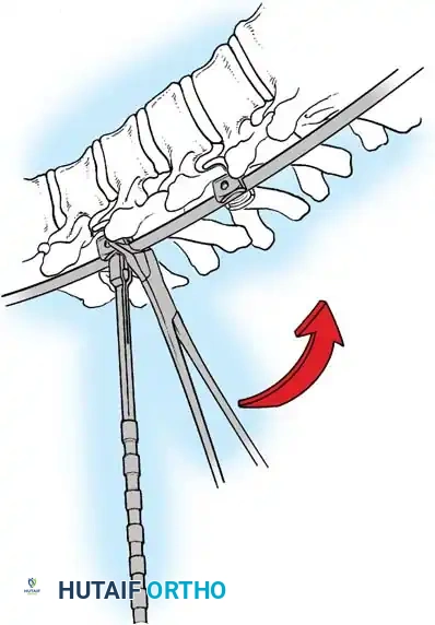 Hutaifortho's Orthopaedic Diagram