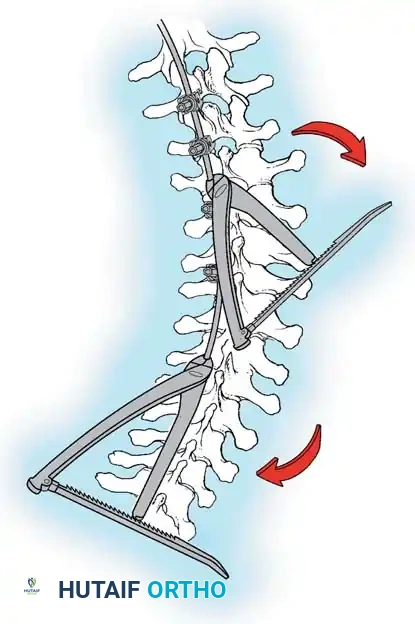 Hutaifortho's Orthopaedic Diagram