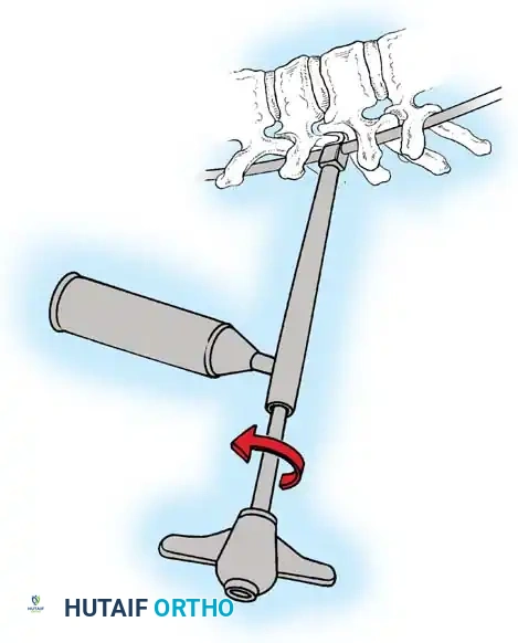 Hutaifortho's Orthopaedic Diagram