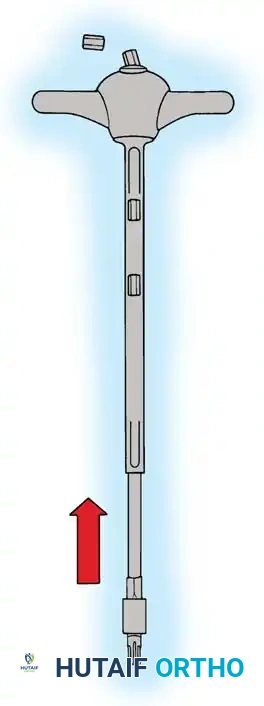 Hutaifortho's Orthopaedic Diagram