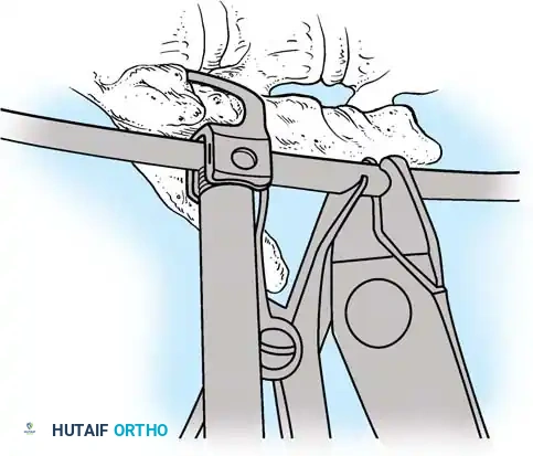 Hutaifortho's Orthopaedic Diagram