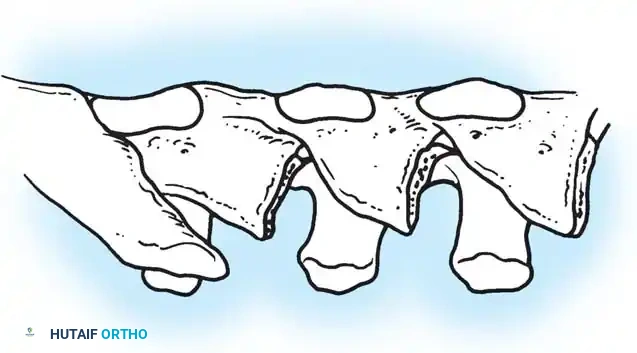 Hutaifortho's Orthopaedic Diagram