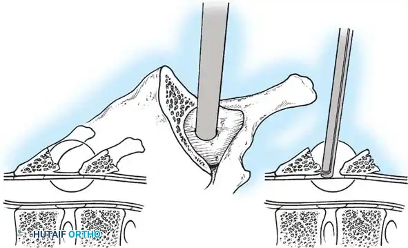 Hutaifortho's Orthopaedic Diagram