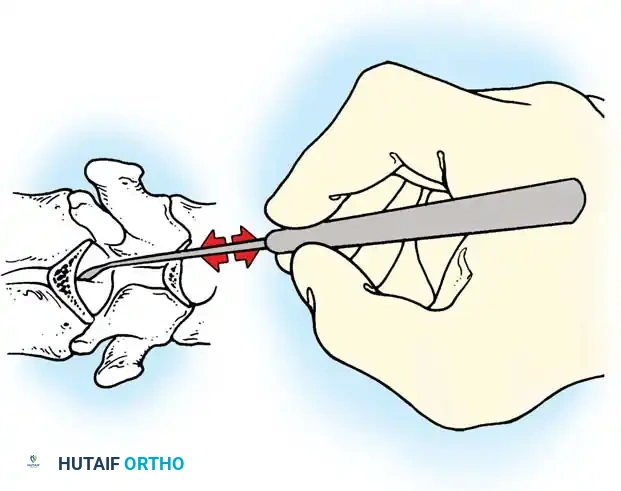 Hutaifortho's Orthopaedic Diagram