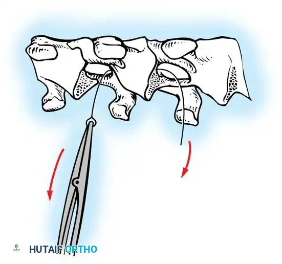 Hutaifortho's Orthopaedic Diagram