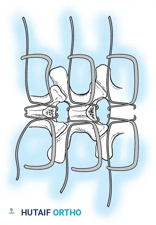 Hutaifortho's Orthopaedic Diagram