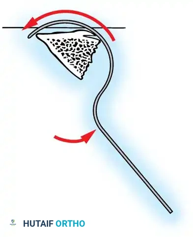 Hutaifortho's Orthopaedic Diagram