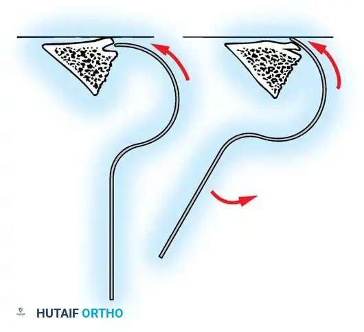 Hutaifortho's Orthopaedic Diagram