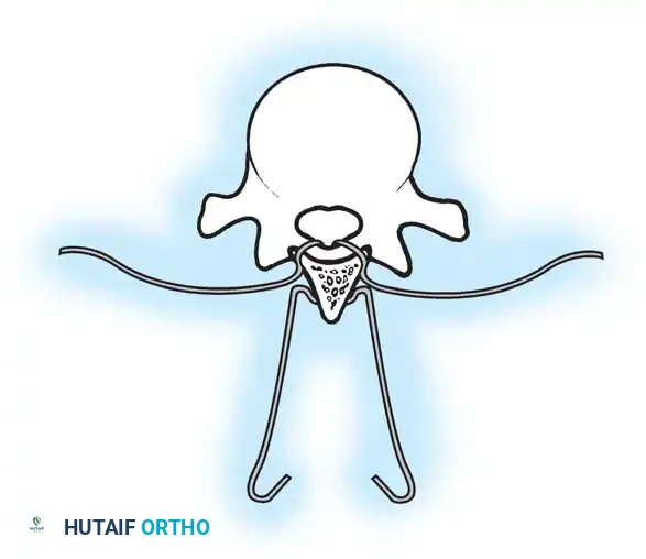 Hutaifortho's Orthopaedic Diagram