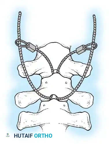 Hutaifortho's Orthopaedic Diagram