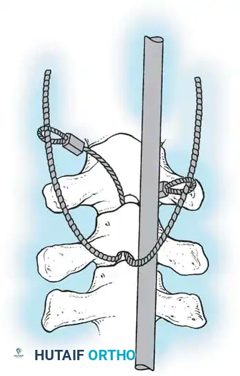Hutaifortho's Orthopaedic Diagram