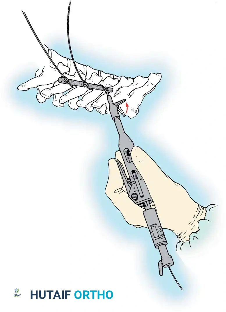 Hutaifortho's Orthopaedic Diagram