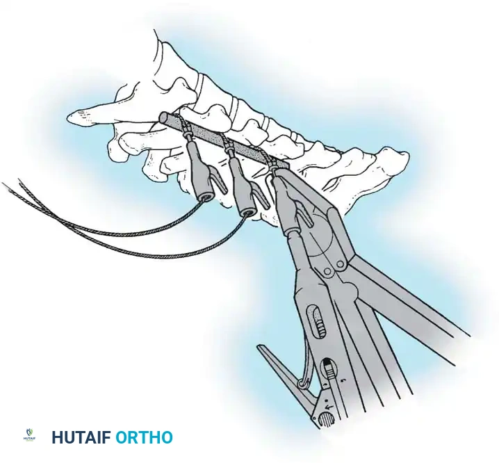 Hutaifortho's Orthopaedic Diagram