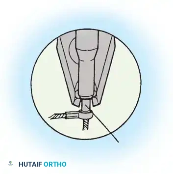 Hutaifortho's Orthopaedic Diagram