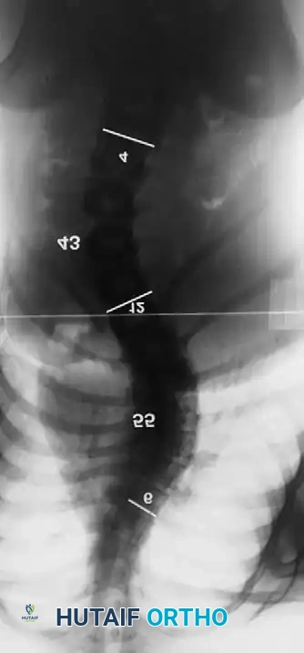 Hutaifortho's Orthopaedic Diagram