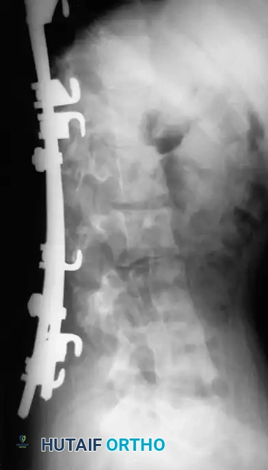 Hutaifortho's Orthopaedic Diagram