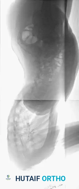 Hutaifortho's Orthopaedic Diagram
