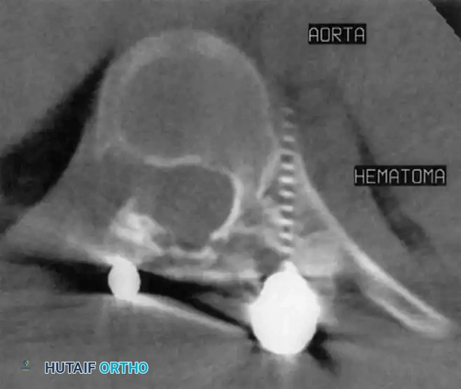 Hutaifortho's Orthopaedic Diagram