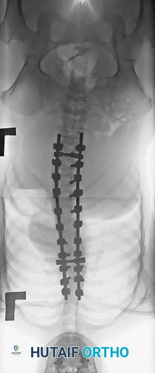 Hutaifortho's Orthopaedic Diagram