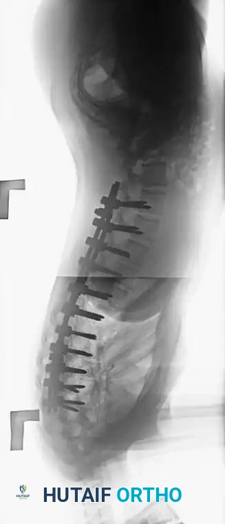 Hutaifortho's Orthopaedic Diagram