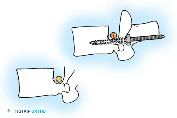 Hutaifortho's Orthopaedic Diagram