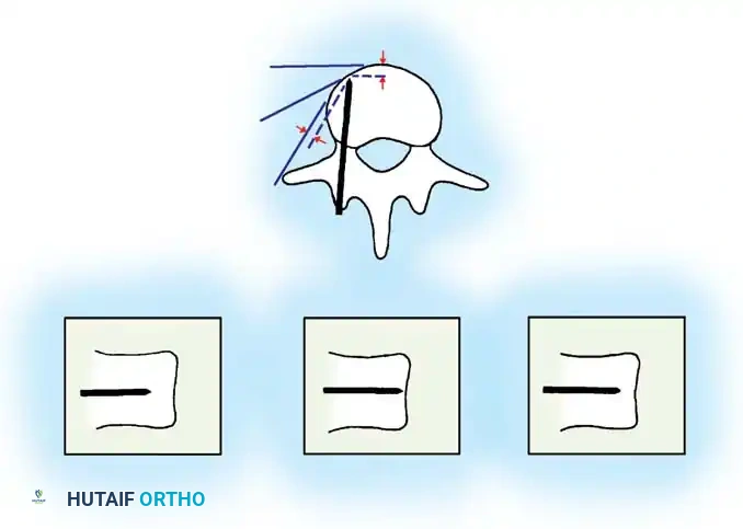 Hutaifortho's Orthopaedic Diagram