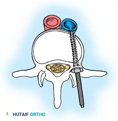 Hutaifortho's Orthopaedic Diagram