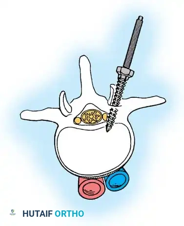 Hutaifortho's Orthopaedic Diagram