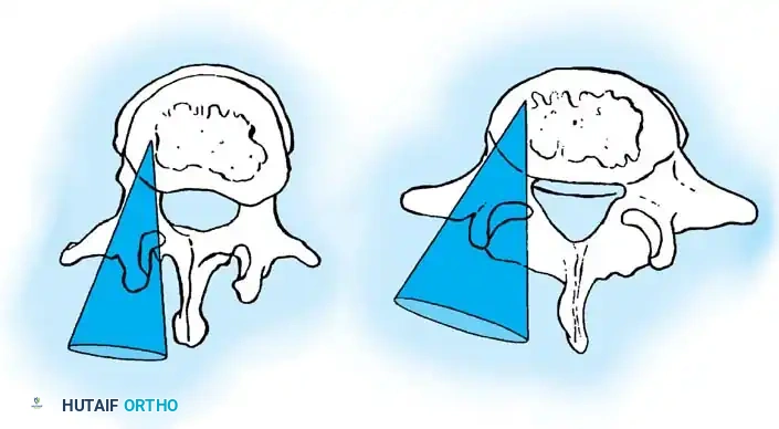 Hutaifortho's Orthopaedic Diagram