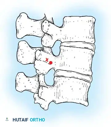 Hutaifortho's Orthopaedic Diagram