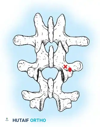 Hutaifortho's Orthopaedic Diagram