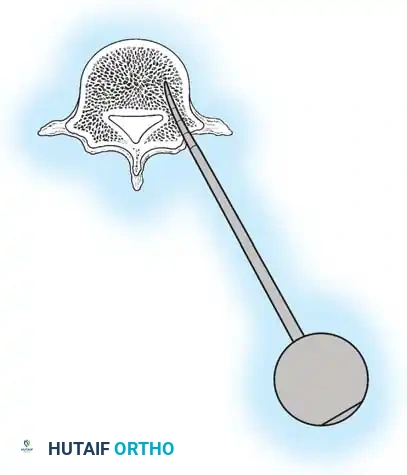 Hutaifortho's Orthopaedic Diagram