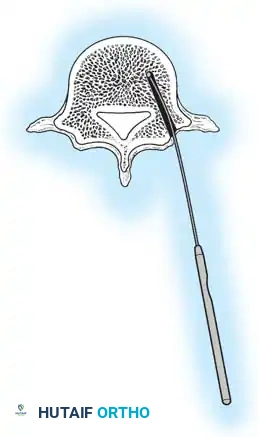 Hutaifortho's Orthopaedic Diagram