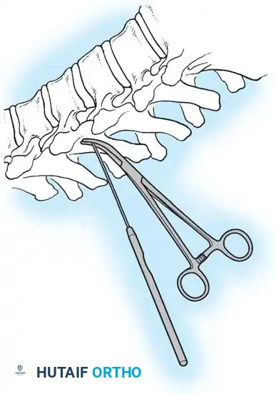 Hutaifortho's Orthopaedic Diagram