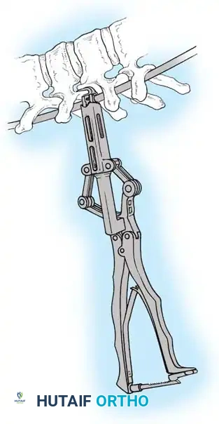 Hutaifortho's Orthopaedic Diagram