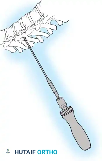 Hutaifortho's Orthopaedic Diagram