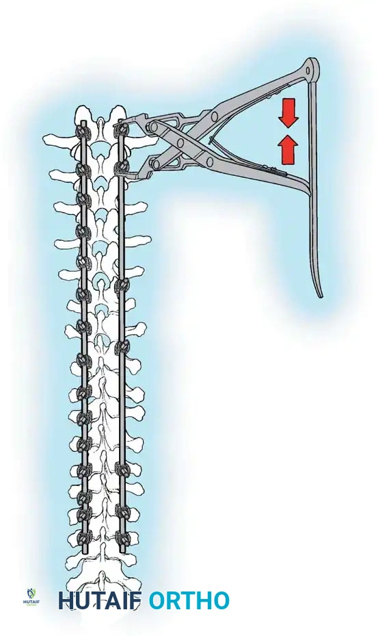Hutaifortho's Orthopaedic Diagram