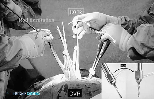 Hutaifortho's Orthopaedic Diagram
